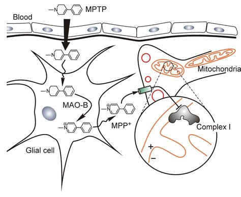 MPTP, Parkinson's disease, Complex I